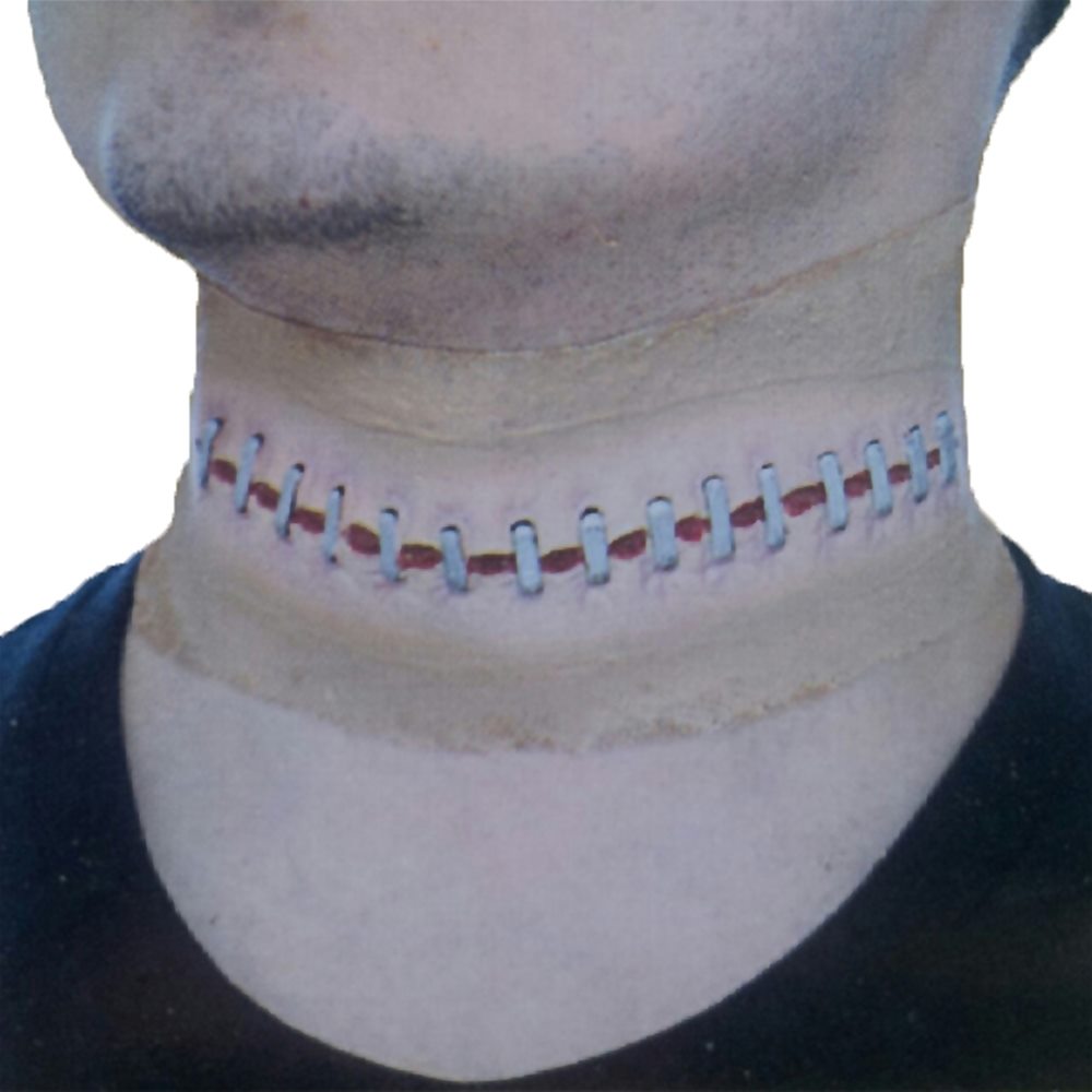 Picture of Wounded Neck Sutures Sleeve