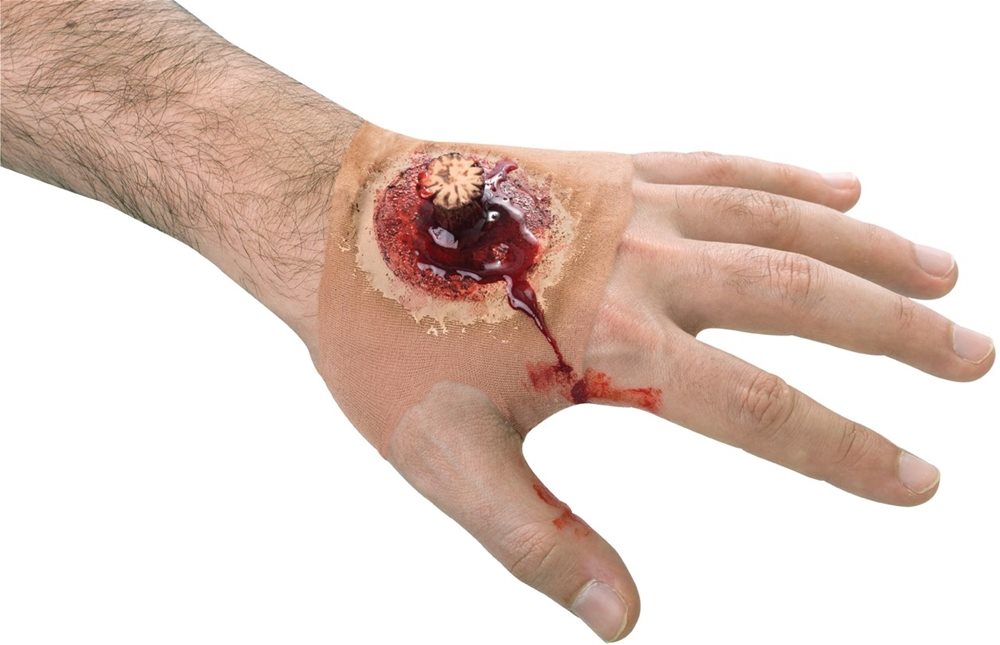 Picture of Splintered Hand Wound Sleeve